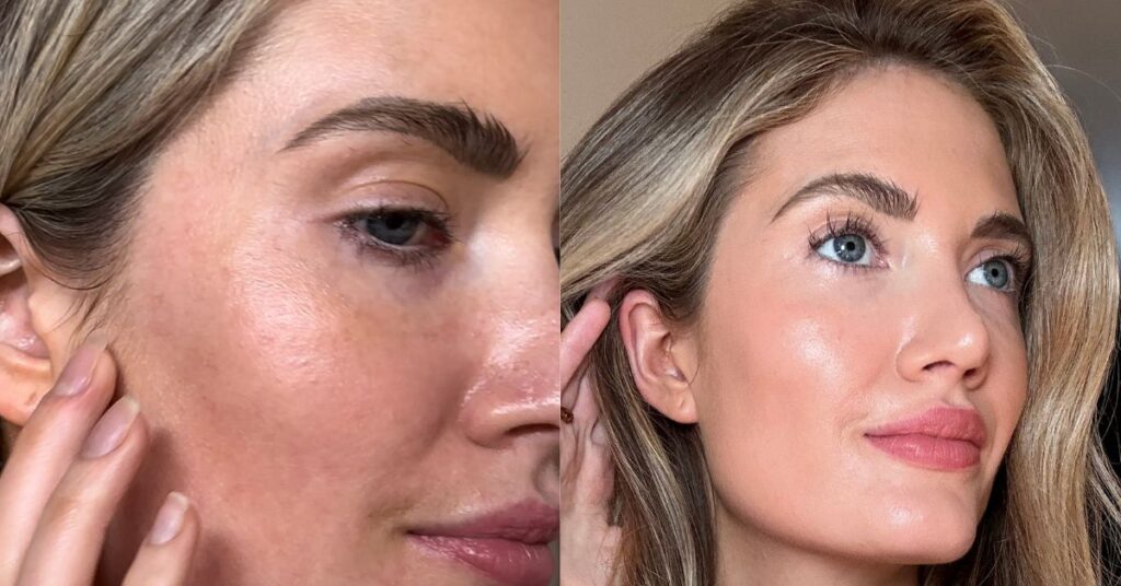 Before-after skincare transformation of a woman's face.